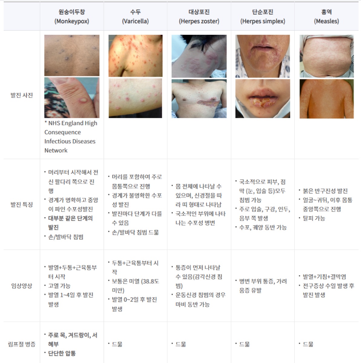 엠폭스(원숭이두창)와 다른 피부질환과의 차이점 [질병관리청]